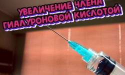 Увеличение члена гиалуроновой кислотой